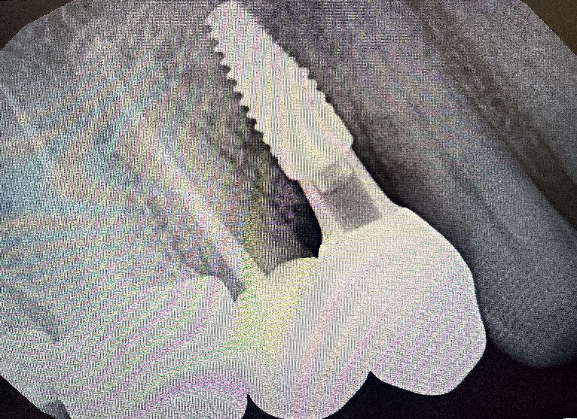 Radiographie d'un implant et de sa couronne (illustration). Photo : DrKemena, CC BY 4.0, Wikimedia Commons.