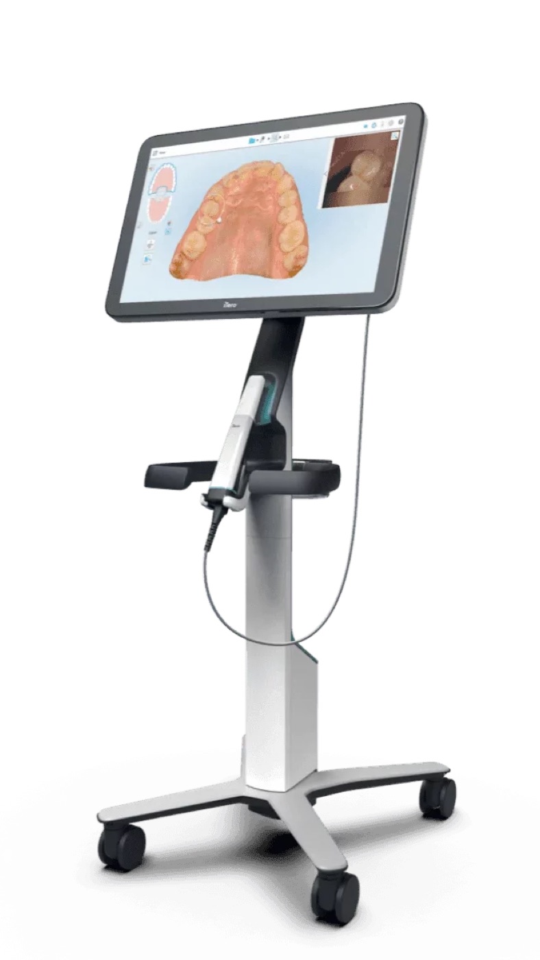 Le scanner iTero Lumina remplace la pâte à empreinte.