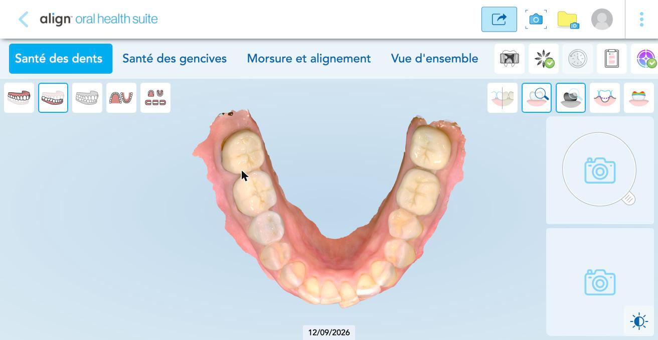 Santé des dents : vue de dessus de l'arcade du bas.
