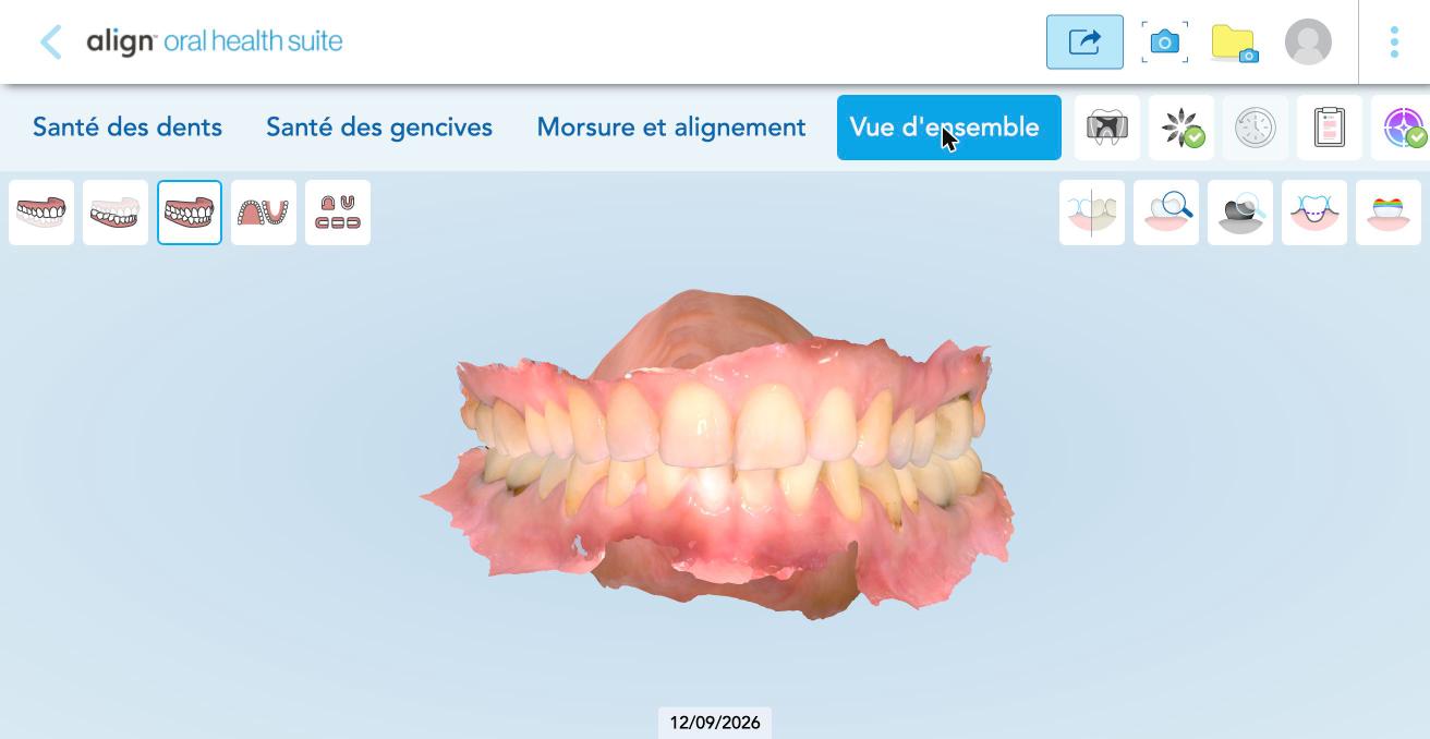 Oral Health Suite, vue d'ensemble : la bouche de la patiente en 3D.